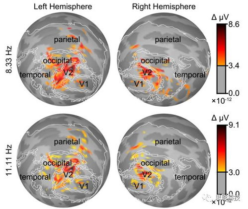 腦磁圖（MEG）數據處理 思影數據處理服務六的專業解決方案